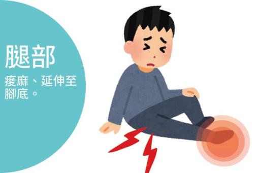 腿部痠麻