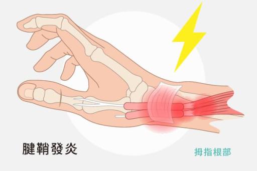 媽媽手