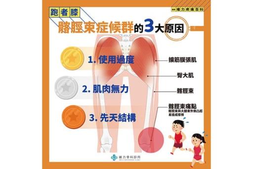 髂脛束症候群