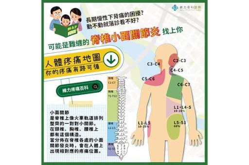 脊椎小面關節炎