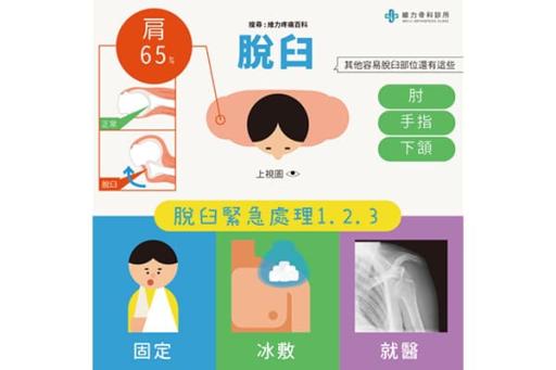 脫臼