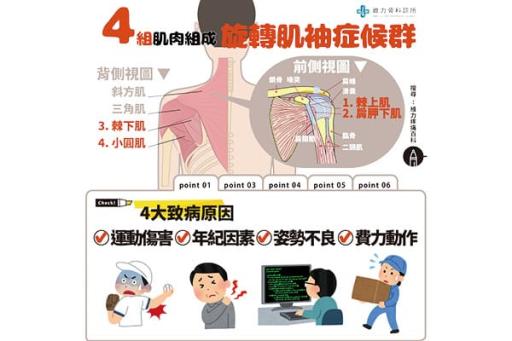 旋轉肌袖症候群