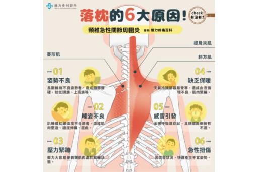 頸椎急性關節周圍炎